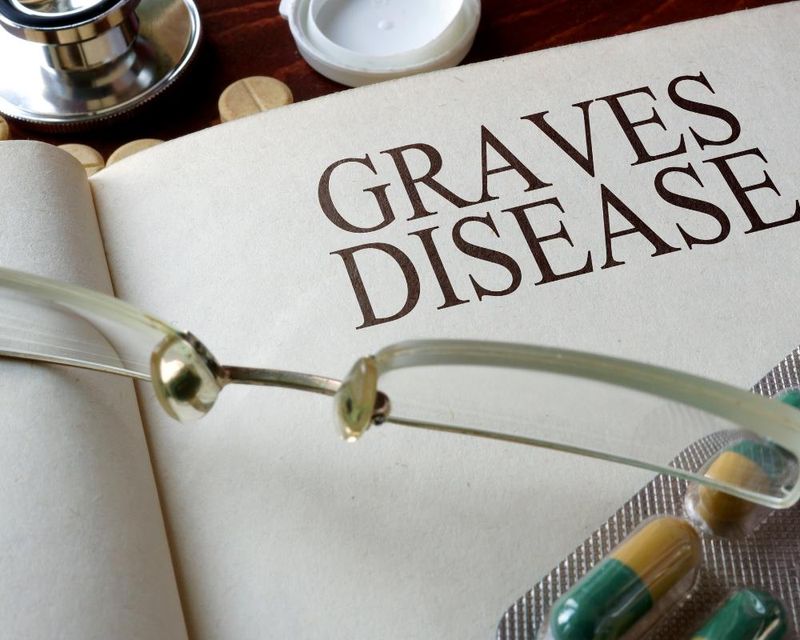 Article Grave's Disease How Does It Affect Your Eyes?